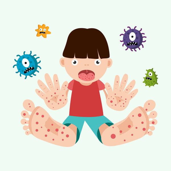 hand foot mouth disease concept. child infected enterovirus. vector illustration