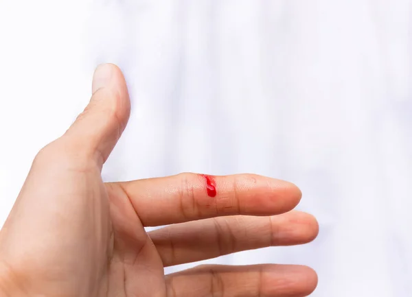 Index Finger Been Cut Hands Bloody — Stock Photo, Image