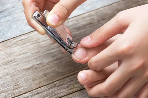 Long Toenails May Cause Problems Wearing Shoes Use Clipper Cut — Stock Photo, Image