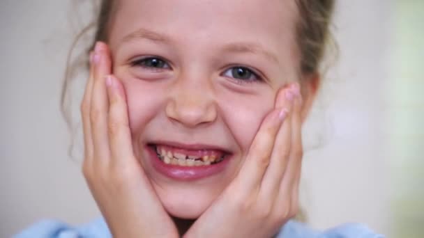 Close Little Child Girl Patient Open Mouth Showing Caries Teeth — 图库视频影像