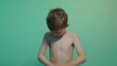 Küçük çocuk kızarık lekeli suçiçeğine yakalanmış ve vücudu kaşınıyor.