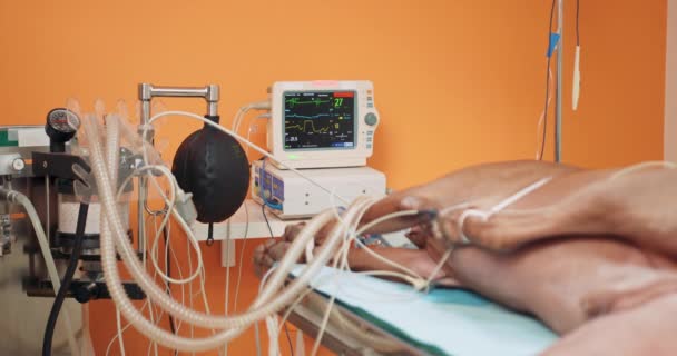 Perro rojo grande anestesiado yace en la mesa de operaciones, y conectado al dispositivo para la ventilación pulmonar artificial con mesa de operaciones y una computadora de dirección en la sala de operaciones Paredes naranjas en — Vídeos de Stock