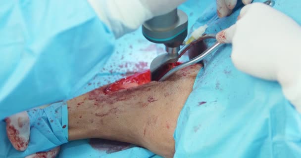 Closeup snit på hundens ben, synlige muskler og væv, indsat nåle, pincet. Hænder af mandlige dyrlæge, i hvide handsker og i kirurgisk tøj, mens han bruger et kirurgisk værktøj i – Stock-video
