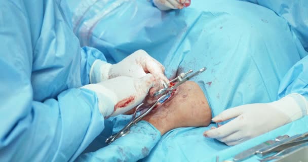 Nacięcie zbliżeniowe na nodze psa, widoczne mięśnie i tkanki, wkłute igły, pęseta. Dłonie męskiego lekarza weterynarii, w białych rękawiczkach i w stroju chirurgicznym, podczas gdy używa narzędzia chirurgicznego do — Wideo stockowe