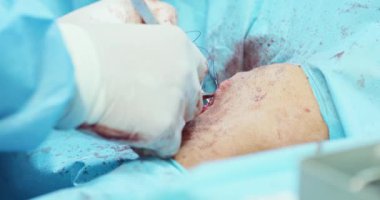 Erkek veterinerin elleri, beyaz eldivenli, cerrahi kıyafetli, ameliyat edilen köpek bacağını ameliyat ipliği, iğne ve cımbızla dikerken.