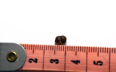Beyaz arka plan üzerinde tek bir düzensiz kahverengi böbrek taşı (renal kalkülüs veya nephrolith), santimetre ölçekli taş, idrarda geçen yaklaşık 6 milimetre boyutunda.