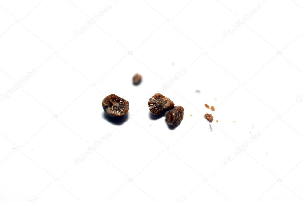 Nephrolithiasis, multiple irregular brown kidney stones and gravels (renal calculi or nephrolith) isolated on white background, the stones are millimeters in size that passed in urine, selective focus