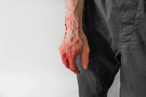 Человек в черных штанах с окровавленной рукой на белом фоне. Руки убийцы и насильника. — стоковое фото