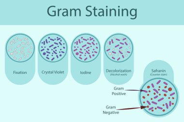 Gram boyama tekniklerini gösteren diyagram - Kristal menekşe ve Safranin kullanan mikrobiyoloji laboratuvarı
