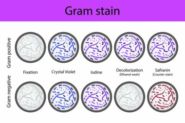 Diagram showing gram staining microbiology lab technique steps - microbiology laboratory using Crystal violet and Safranin clipart