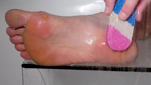 靴から損傷を受けた足は スクラブで男の足の足を洗うと 足の上に皮膚が剥離されます 乾燥肌 足の乾癬 皮膚が損傷している 皮膚炎 アレルギー反応 — ストック動画