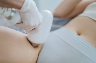 Kozmetik kliniğinde lazerle kadın bacağı epilasyonu.