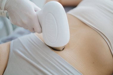 Kozmetik kliniğinde lazerle kadın karnındaki kılların alınması.