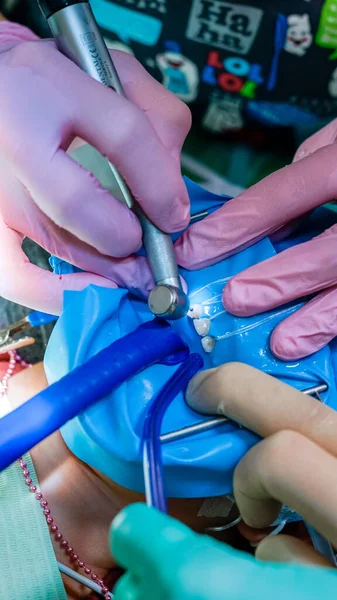 Zahnbehandlung Weibliche Zähne Behandlung — Stockfoto
