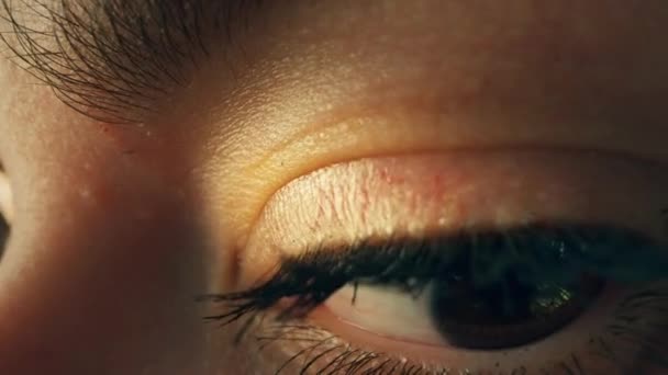 Макро знімок жіночого ока. Розлад дефіциту уваги, жінка не зосереджена, уникає зору — стокове відео