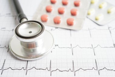 Uyuşturucu, kalp dalgası, kalp krizi, kardiyogram raporu ile birlikte elektrokardiyogram (ECG) üzerinde stetoskop.
