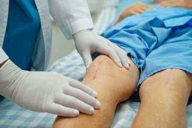 Doktor, hastanede dizinde yara izi olan Asyalı yaşlı kadın hastayı kontrol ediyor..