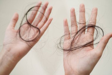 Asian woman have problem with long hair loss attach in her hand.