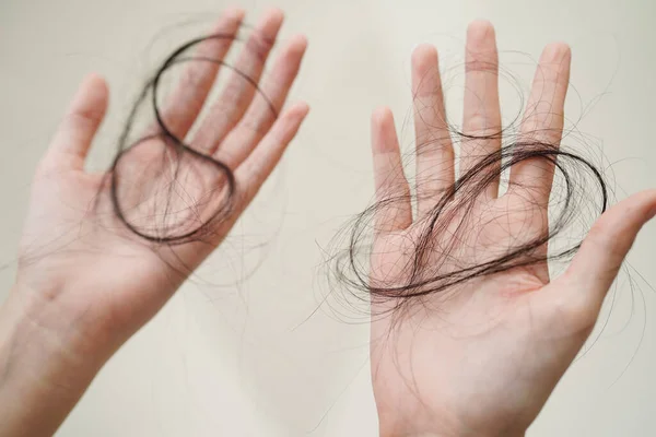 Asian Woman Have Problem Long Hair Loss Attach Her Hand — 图库照片