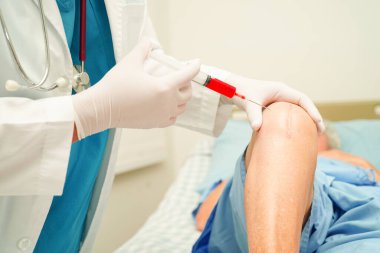 Asyalı doktor, Hyaluronic asit trombosit enjekte ederek yaşlı kadının dizine zengin plazma enjekte etti..