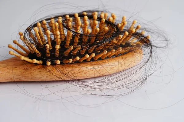 Queda Perda Cabelo Com Escova Pente Isolado Fundo Branco — Fotografia de Stock