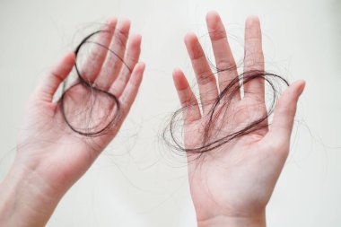 Asian woman have problem with long hair loss attach in her hand.