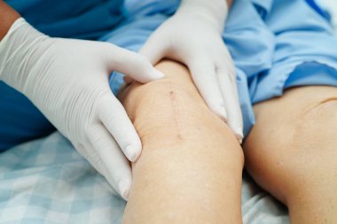 Doktor, hastanede dizinde yara izi olan Asyalı yaşlı kadın hastayı kontrol ediyor..