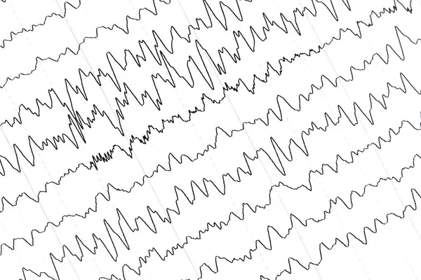 Fransız Okyanusu tarafından yapılan 2 frank.