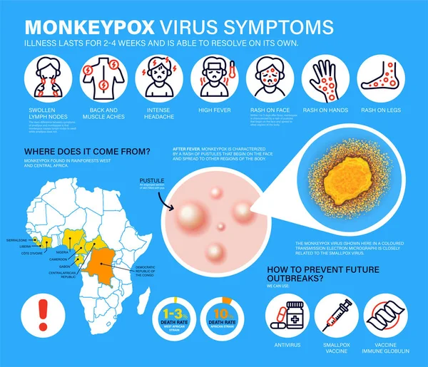 猴痘病毒症状 在欧洲和美国报告了新的猴痘病毒病例 猴痘正在欧洲蔓延 它引起皮肤感染 猴痘病毒详细资讯图 — 图库矢量图片