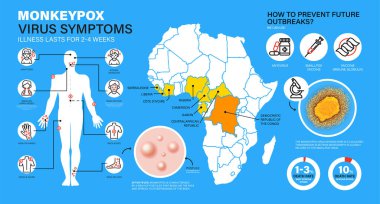 Monkeypox infographics. Monkeypox virus Symptoms. New cases of Monkeypox virus are reported in Europe and USA. Monkeypox is spreading in the Europe. It cause skin infections.  clipart