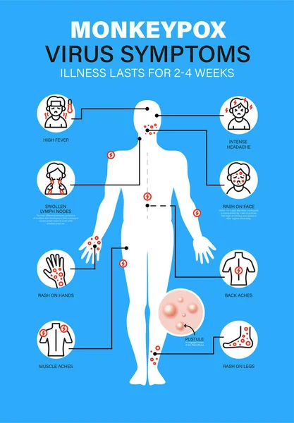 Virus Monkeypox Síntomas Han Notificado Nuevos Casos Virus Viruela Monkeypox — Vector de stock