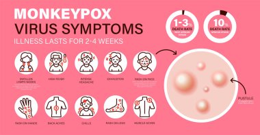 Monkeypox virus Symptoms. New cases of Monkeypox virus are reported in Europe and USA. Monkeypox is spreading in the Europe. It cause skin infections. Monkeypox virus Symptom infographics clipart