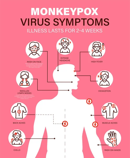 Virus Variole Singe Symptômes Nouveaux Cas Virus Variole Singe Sont — Image vectorielle