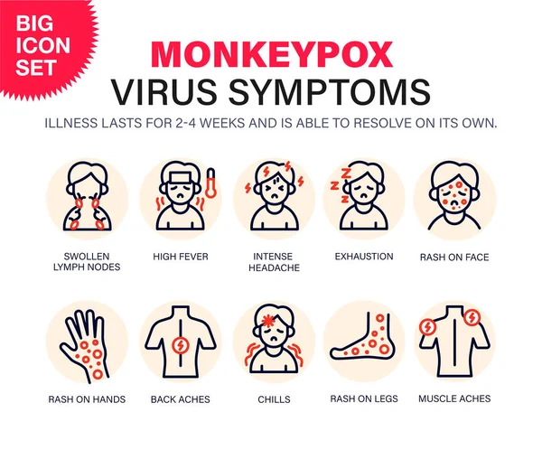 猴痘病毒症状 在欧洲和美国报告了新的猴痘病毒病例 猴痘正在欧洲蔓延 会引起皮肤感染 — 图库矢量图片