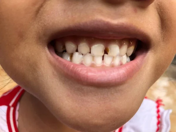 düzensiz ağız ve dişler