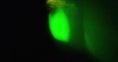 Meraklı Işık Sızıntısı Geçiş Üstüste 60 fps