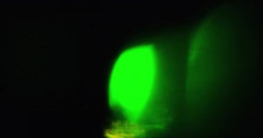 Maniacal Işık Sızıntısı Geçiş Üstüste 60 fps