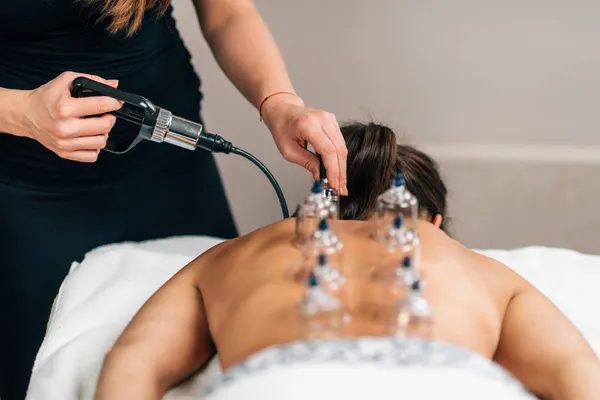 Cupping Therapy Women Back — Stock Photo, Image