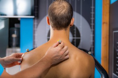 3 Boyutlu Gait ve Yürüyen Analizler İçin Mans Back 'e İşaretler Yerleştiriliyor 