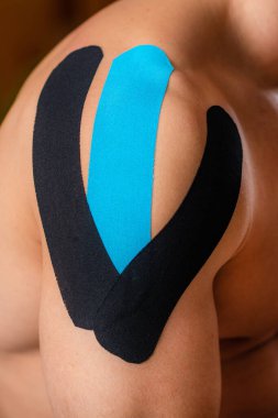 Kineziyoloji terapi bandı. Omzunda elastik yapışkan bant olan hasta..