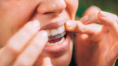 Whitening Stipes ya da Whitestrips kullanan bir kadın. Evde Beyaz Dişler. 