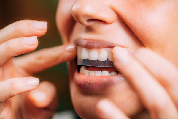 Kobieta Używająca Wybielaczy Lub Whitestrips Wybielanie Zębów Domu — Zdjęcie stockowe