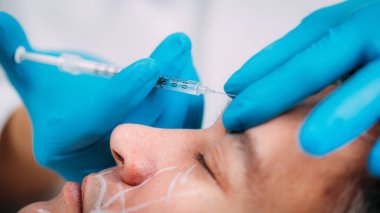 Deri doldurucu enjeksiyonu. Orta yaşlı bir adam alnındaki kırışıklıkları azaltmak için cilt dolgusu yaptırıyor.. 