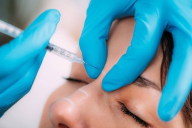 Deri doldurucu enjeksiyon tedavisi. Doktor ameliyat eldivenleriyle kadınların burun köprüsüne deri doldurucu enjekte ediyor..    