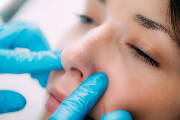 Doctor Preparing Dermal Filler Treatment Womans Nose — Foto Stock