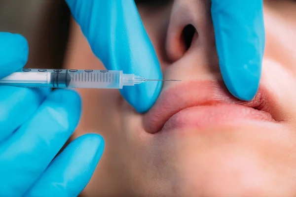 Médico Injetando Preenchimento Dérmico Nos Lábios Das Mulheres — Fotografia de Stock