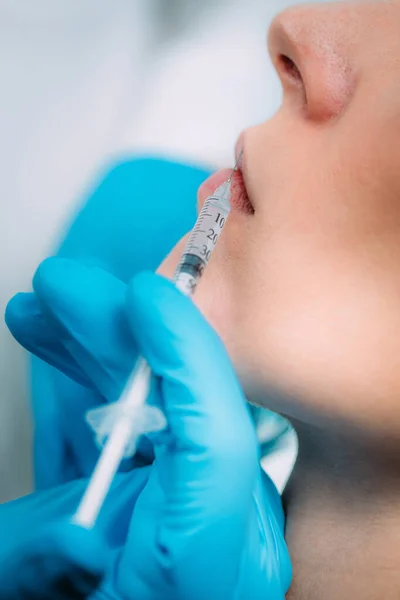 Médico Injetando Preenchimento Dérmico Nos Lábios Das Mulheres — Fotografia de Stock