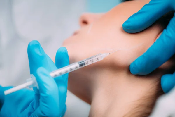 Tratamento Envelhecimento Médico Com Luvas Cirúrgicas Injetando Preenchimento Dérmico Rosto — Fotografia de Stock