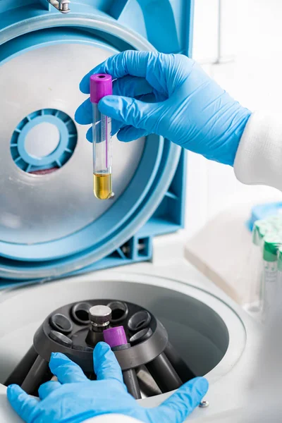 Odwirowanie Próbki Laboratorium — Zdjęcie stockowe
