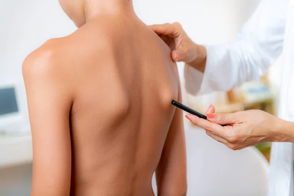 Pediatric Doctor Examining Posture Boy Making Marks His Back Checking —  Fotos de Stock